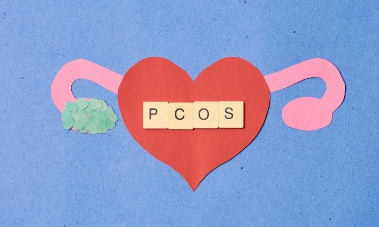 Illustrazione di ovaie e utero con la sigla PCOS