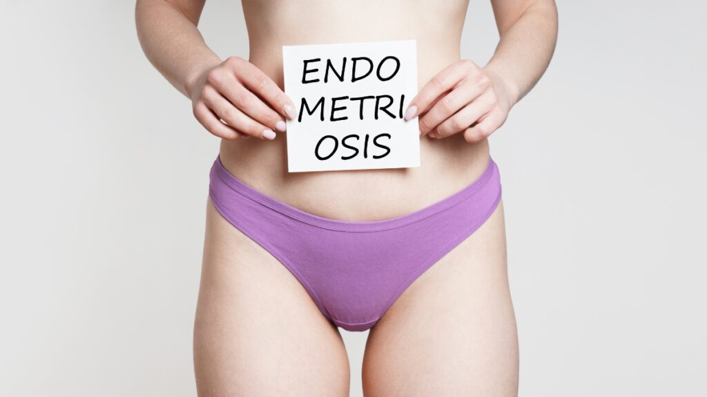 Donna con la scritta Endometriosis sull’addome, per illustrare endometriosi e microbiota