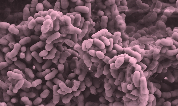 Biofilm di Gardnerella osservato al microscopio elettronico, per illustrare lattobacilli contro Gardnerella