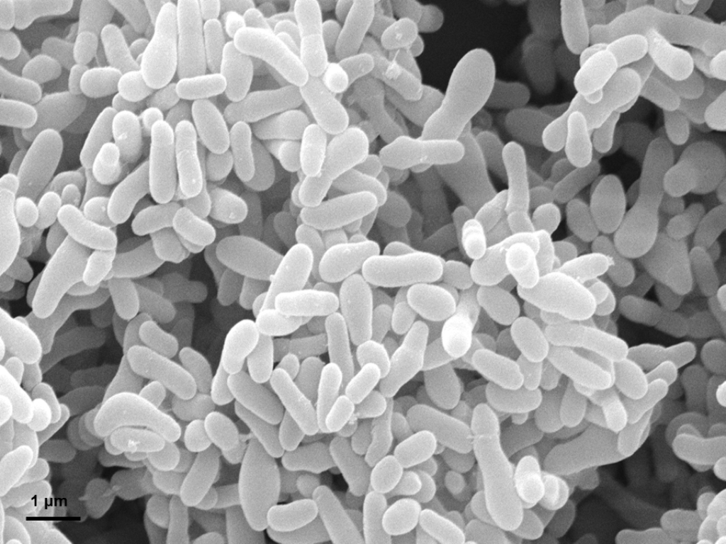 Gardnerella vaginalis osservata al microscopio elettronico, per illustrare funzioni del microbiota vaginale